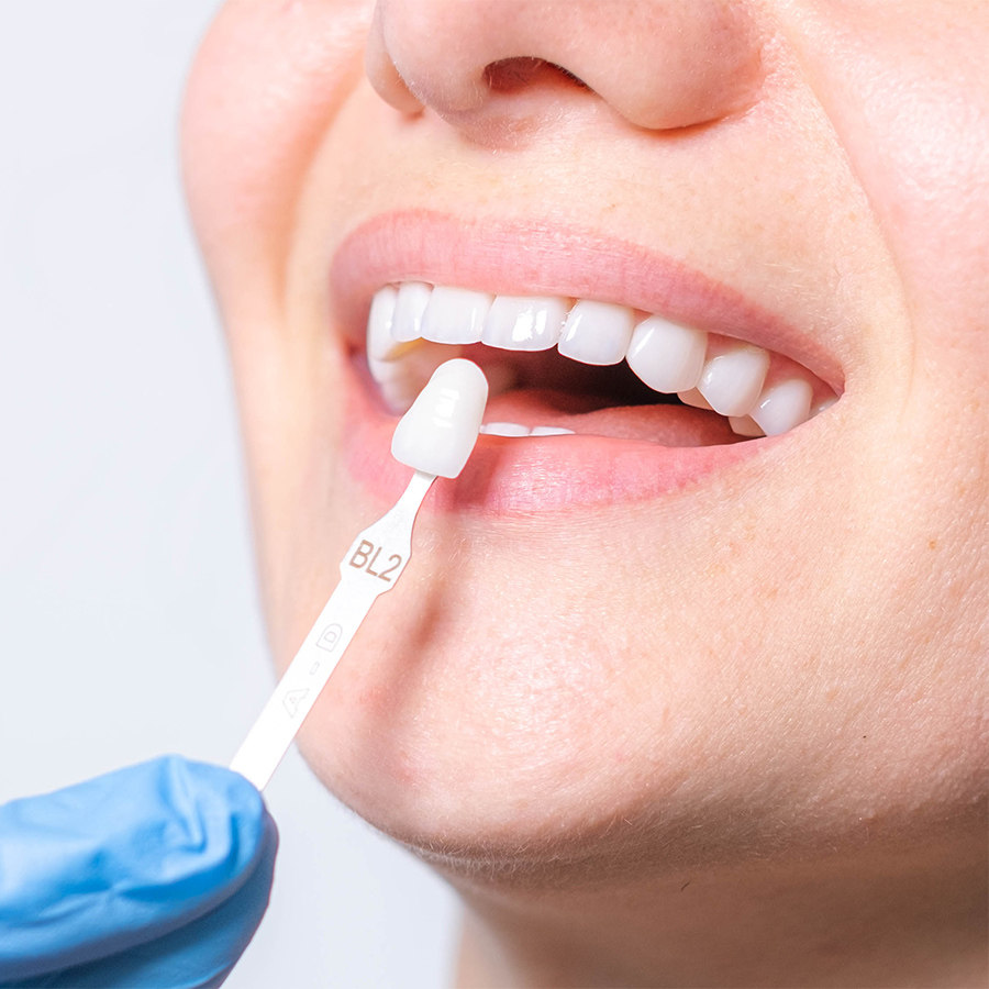 Ästhetische Zahnmedizin Düsseldorf Frau mit strahlend weißen Zähnen