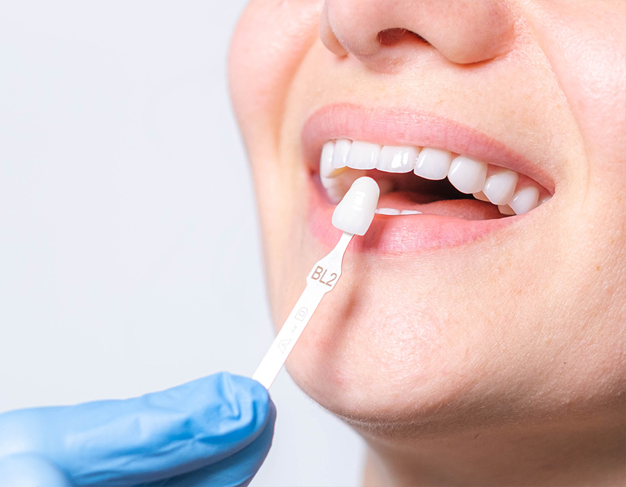 Frau mit strahlend weißen Zähnen