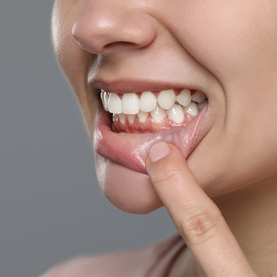 Frau mit strahlend weißen Zähnen