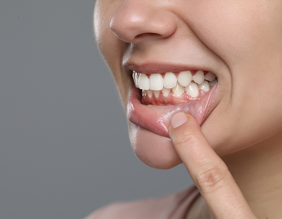 Frau mit strahlend weißen Zähnen